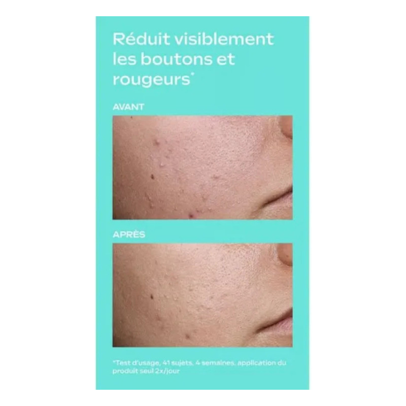 Weleda Clear & Pure Skin...