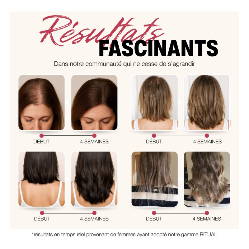ROSEGOLD Rosehair Set...