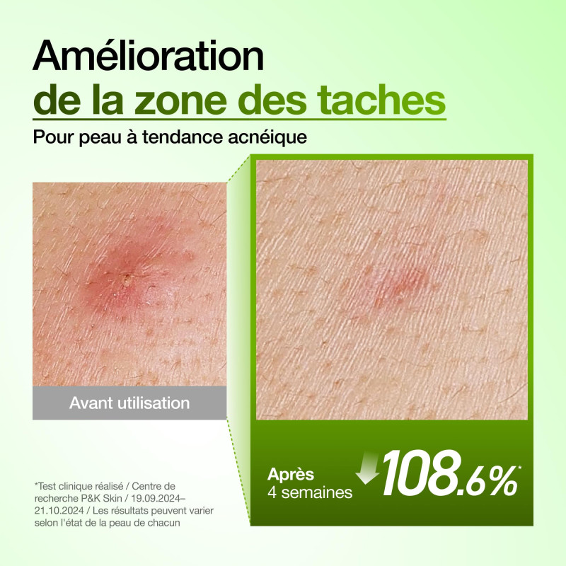 Anua Suero calmante para el...
